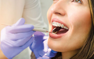 adult braces garden grove ca