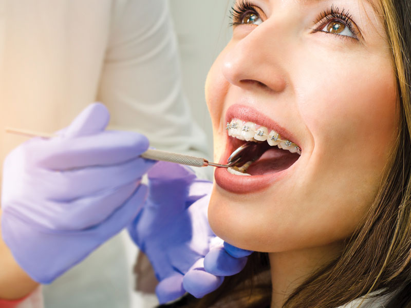 adult braces garden grove ca