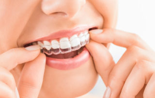 best-orthodontist-garden-grove-orange-county-ca