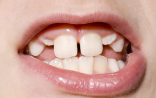 family dentist garden grove ca