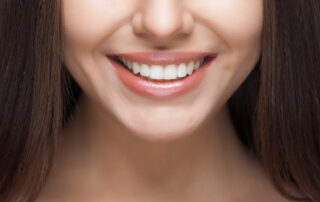 teeth-whitening-family-dentist-orthodontist-garden-grove-orange-county