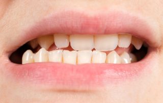 family kids orthodontist garden grove ca