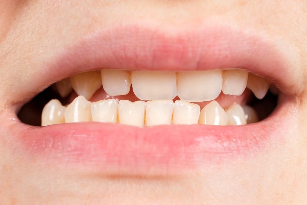 family kids orthodontist garden grove ca