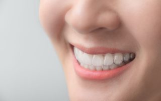 clear aligners for teens garden grove orange county