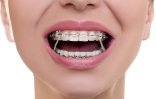 best orthodontic treatment garden grove orange county