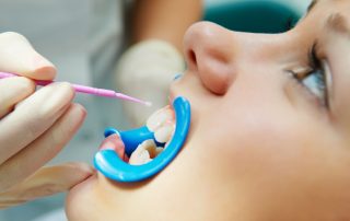 friendly family dentist garden grove ca