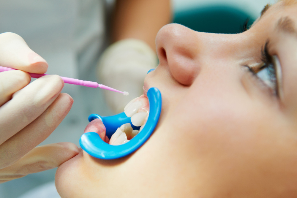 friendly family dentist garden grove ca