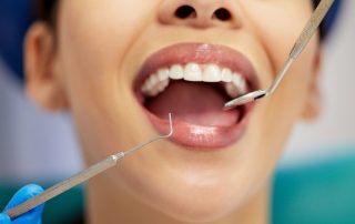 Why Regular Dental Cleanings Are Essential for a Healthy Smile