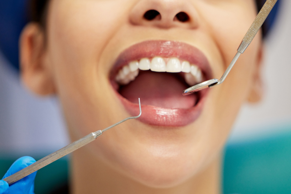 Why Regular Dental Cleanings Are Essential for a Healthy Smile