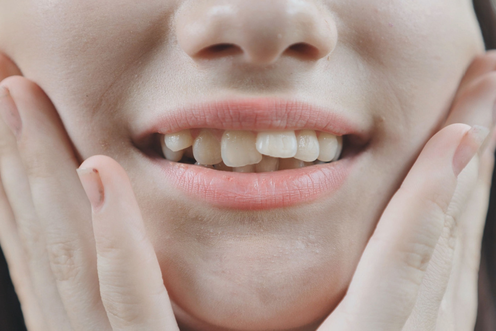 orthodontic treatment for crowded teeth garden grove ca