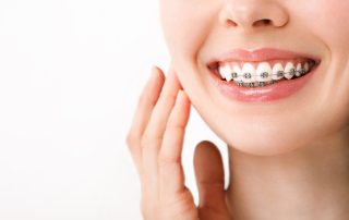 A Guide to Choosing the Right Orthodontic Treatment