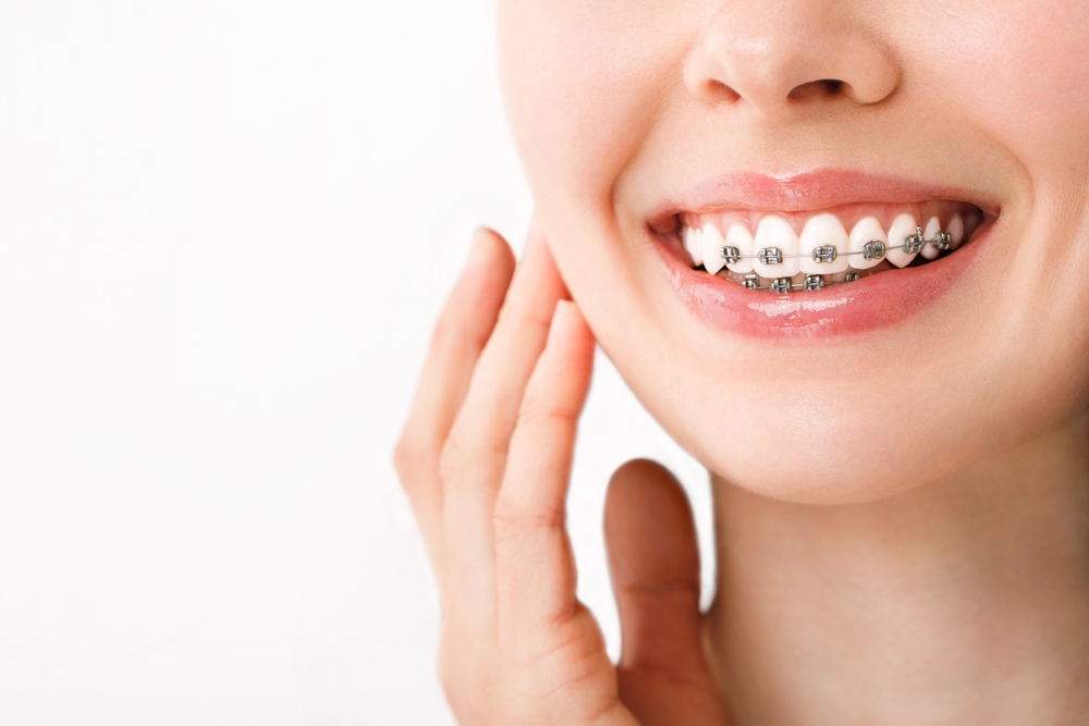 A Guide to Choosing the Right Orthodontic Treatment