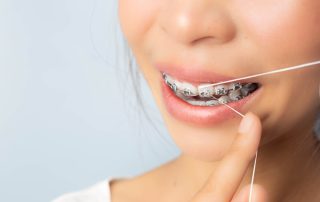 Mastering Dental Hygiene During Orthodontic Treatment