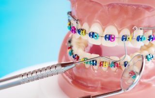The Cost of Orthodontic Treatment: What You Need to Know