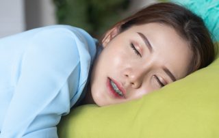 Orthodontic Treatment and Snoring